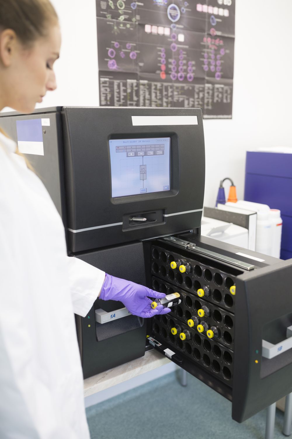 gut microbiome analysis
